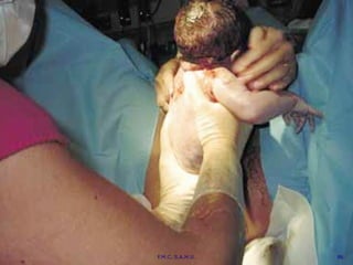 86
F.M.C. S.A.M.U. 86
 