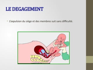 LE DEGAGEMENT
• L’expulsion du siège et des membres suit sans difficulté.
 
