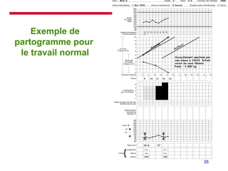 Partogramme Who Accouchement normal-partogramme( surveillance) .ppt