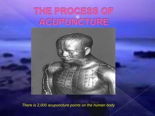 There is 2,000 acupuncture points on the human body
 