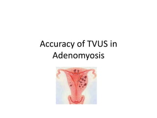 Accuracy of TVUS in
Adenomyosis
 