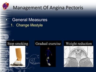 Management Of Angina Pectoris General Measures Change lifestyle Stop smoking Gradual exercise Weight reduction  