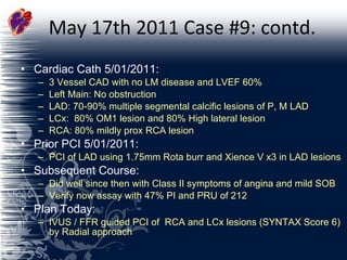 May 17th 2011 Case #9: contd. Cardiac Cath 5/01/2011:  3 Vessel CAD with no LM disease and LVEF 60% Left Main: No obstruction LAD: 70-90% multiple segmental calcific lesions of P, M LAD LCx:  80% OM1 lesion and 80% High lateral lesion RCA: 80% mildly prox RCA lesion Prior PCI 5/01/2011:  PCI of LAD using 1.75mm Rota burr and Xience V x3 in LAD lesions  Subsequent Course: Did well since then with Class II symptoms of angina and mild SOB Verify now assay with 47% PI and PRU of 212 Plan Today:  IVUS / FFR guided PCI of  RCA and LCx lesions (SYNTAX Score 6) by Radial approach 