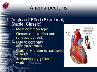 Angina pectoris Angina of Effort (Exertional, Stable, Classic): Most common type. Occurs on exertion and relieved by rest. Due to coronary atherosclerosis Coronary lumen is narrowed & fixed. Treatment by  ↓  Cardiac work. 