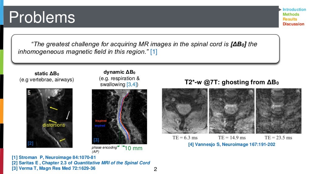 Integrated RF and Shim coils for MRI