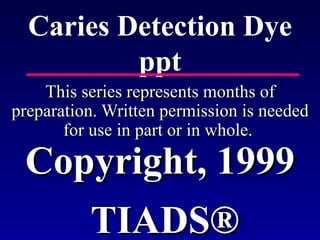 Caries Detection Dye ppt This series represents months of preparation. Written permission is needed for use in part or in whole.  Copyright, 1999 TIADS ® 