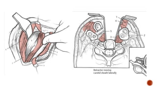 ACDF presentation concise information provided | PPTX