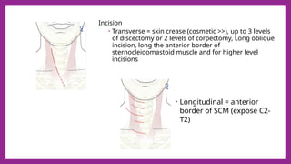 Comprehensive Guide to Anterior Cervical Discectomy and Fusion (ACDF ...