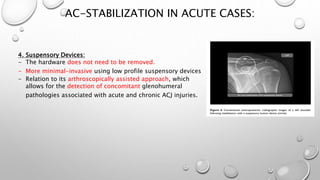 Ac dislocation dangtoandhy | PPTX
