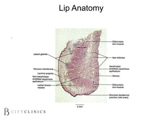 Lip Anatomy
 