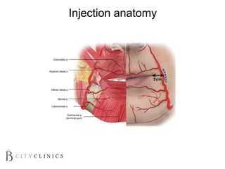 Injection anatomy
 