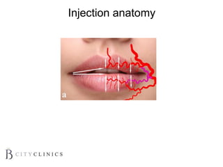 Injection anatomy
 