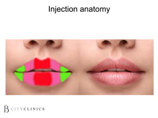 Injection anatomy
 