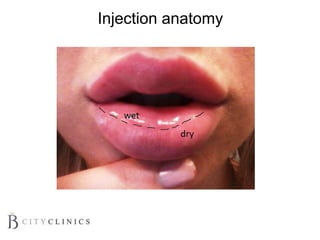Injection anatomy
 