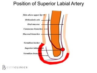 Position of Superior Labial Artery
 