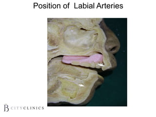 Position of Labial Arteries
 