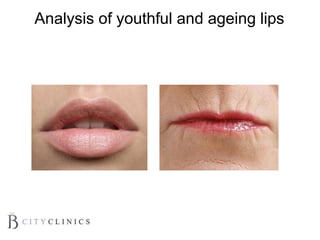 Analysis of youthful and ageing lips
 