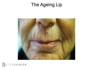 The Ageing Lip
 