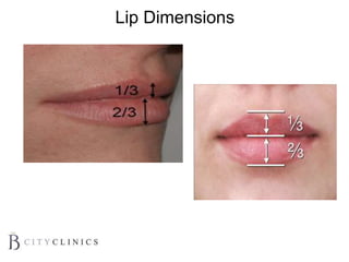 Lip Dimensions
 