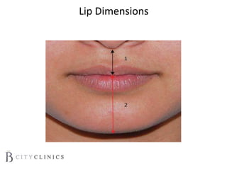 Lip Dimensions
 