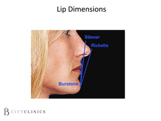 Lip Dimensions
 