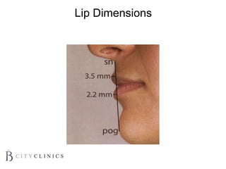 Lip Dimensions
 