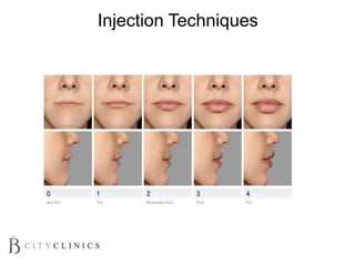 Injection Techniques
 