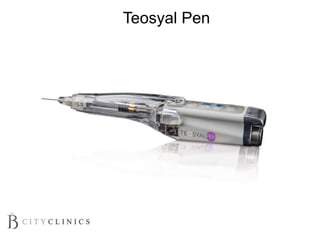Teosyal Pen
 