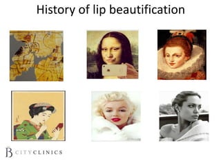 History of lip beautification
 