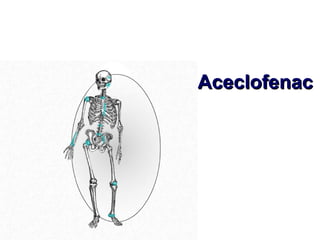 Aceclofenac
 