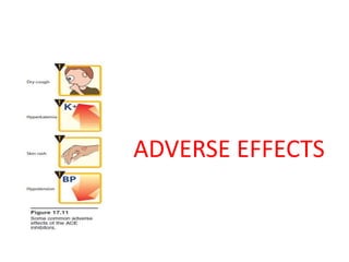 Acei | PPTX