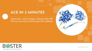 www.bosterbio.com
ACE IN 3 MINUTES
Quick facts, control designs, Western Blot MW.
Info you can use to find the best ACE antibody.
 