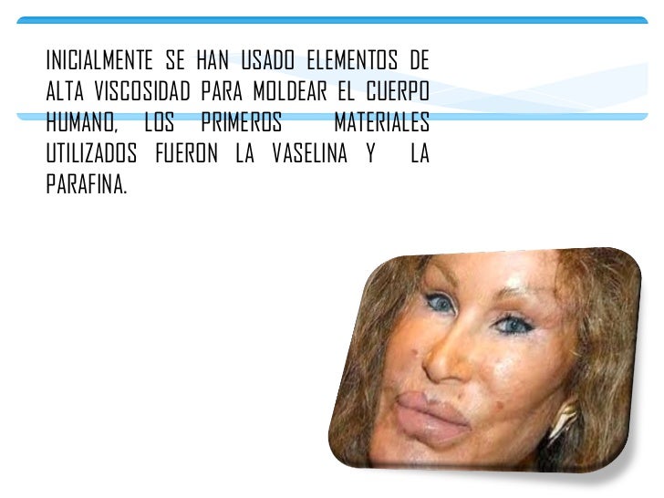 Que se distingue el ajuste de la persona de la operación de la persona
