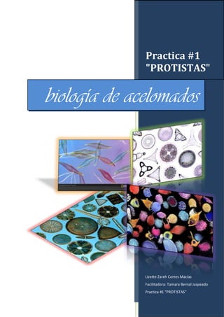 Practica #1
"PROTISTAS"

biología de acelomados

Lizette Zareh Cortes Macías
Facilitadora: Tamara Bernal Jaspeado
Practica #1 "PROTISTAS"

 