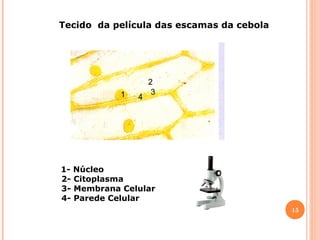 Tecido da película das escamas da cebola

1

4

2
3

1- Núcleo
2- Citoplasma
3- Membrana Celular
4- Parede Celular
15

 