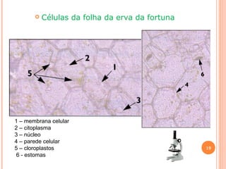 

Células da folha da erva da fortuna

1 – membrana celular
2 – citoplasma
3 – núcleo
4 – parede celular
5 – cloroplastos
6 - estomas

19

 