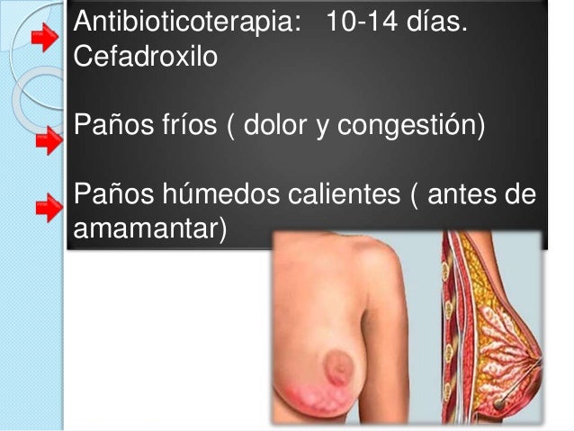 Si es hermoso el pecho de silicio
