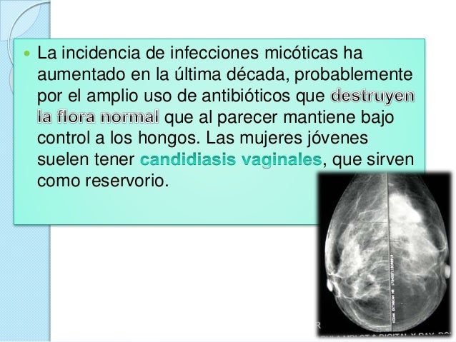 Fenhel para el aumento del pecho