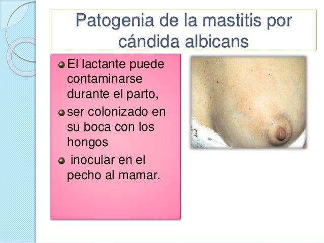 El hidrato de amonio el hongo de las uñas las revocaciones