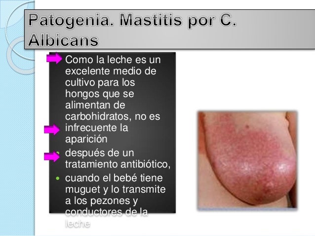 Guam de la crema para el aumento del pecho inthenso