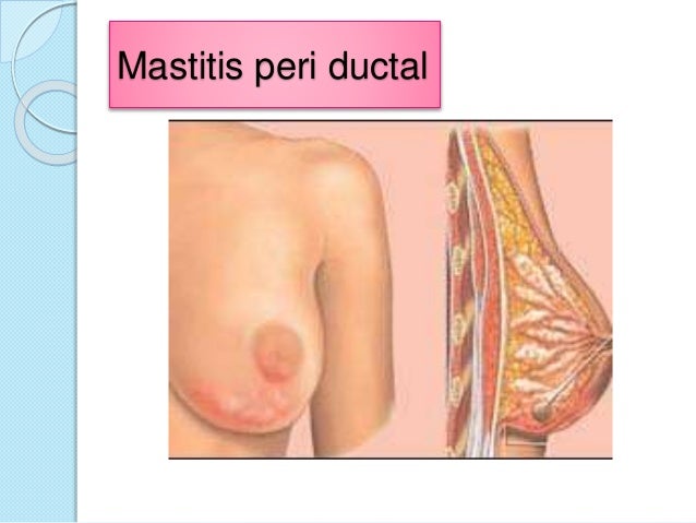 La crema para el aumento del busto con las hormonas