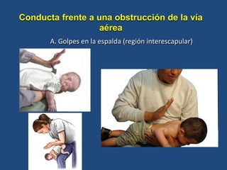 A. Golpes en la espalda (región interescapular)
Conducta frente a una obstrucción de la vía
aérea
 