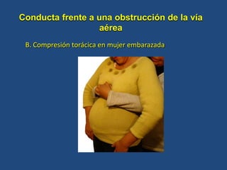 Conducta frente a una obstrucción de la vía
aérea
B. Compresión torácica en mujer embarazada
 