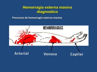 Hemorragia externa masiva
diagnostico
Presencia de hemorragia externa masiva
 