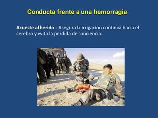 Conducta frente a una hemorragia
Acueste al herido.- Asegura la irrigación continua hacia el
cerebro y evita la perdida de conciencia.
 