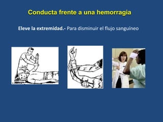 Eleve la extremidad.- Para disminuir el flujo sanguíneo
Conducta frente a una hemorragia
 