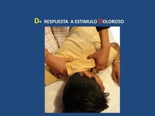 D= RESPUESTA A ESTIMULO DOLOROSO
 