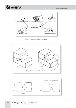 Soldagem dos aços inoxidáveis
Detalhes típicos de fusão incompleta
44
 