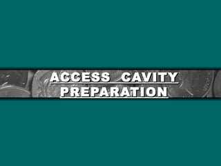 ACCESS CAVITY
 PREPARATION
 
