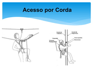 Acesso por Corda  